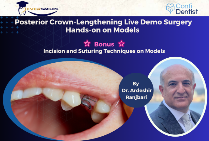 Posterior Crown-Lengthening FEATURED IMAGE